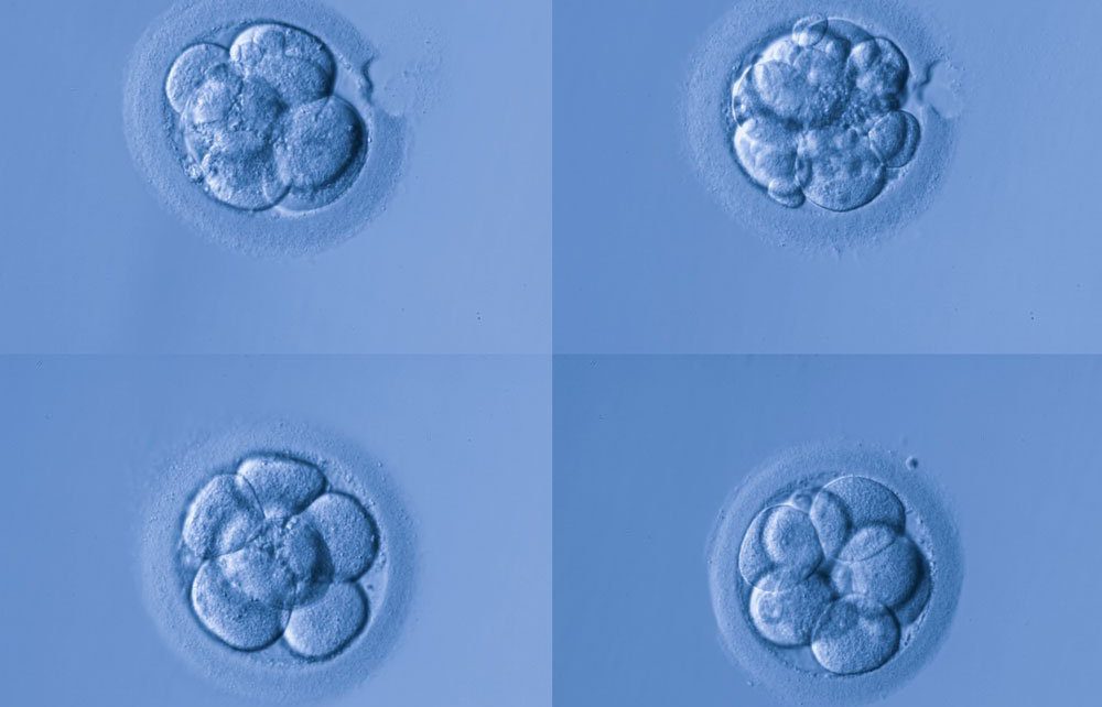 Ricercatori dell’Instituto Bernabeu scoprono che il mosaicismo cromosomico può dare origine a gravidanze evolutive di bambini sani