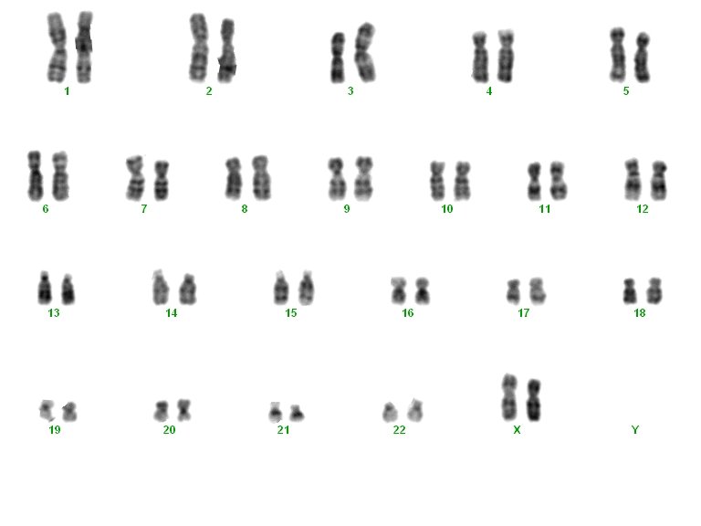 Clinical study on the risks of chromosomally abnormal embryos in very young mothers