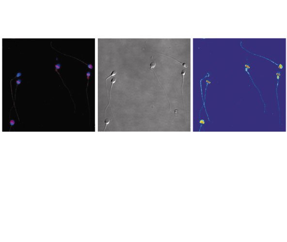 Das Instituto Bernabeu und der Lehrstuhl für Reproduktionsmedizin an der UA präsentieren beim Kongress für Histologie eine Untersuchung über den Einfluss des Nikotins auf die Spermien