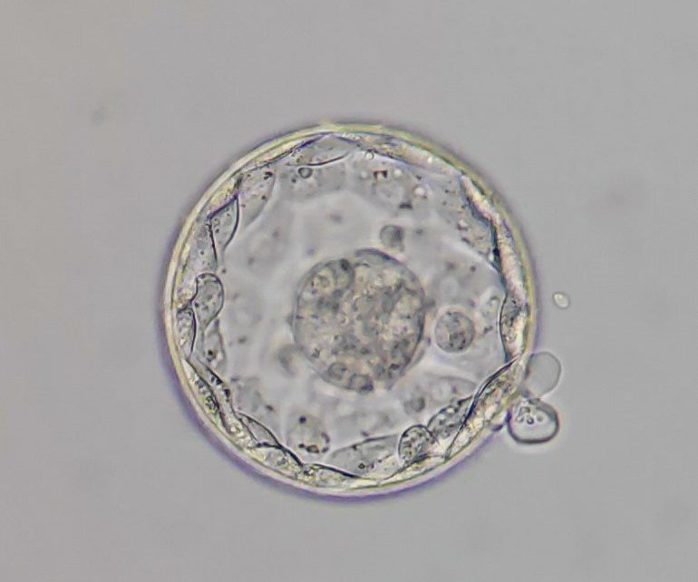 Eine Studie des Instituto Bernabeu erforscht, ob unterschiedliche Typen von ovarieller Stimulation für eine IVF Auswirkungen auf die Chromosomenveränderungen des Embryos haben