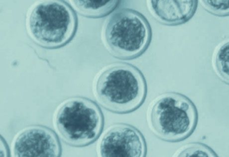 Was geschieht mit den überschüssigen Embryonen aus einer Behandlung der künstlichen Befruchtung?