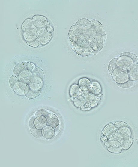 Adoption von embryos