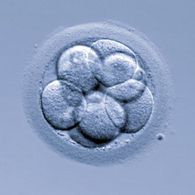 Fallo de implantación embrionario y aborto de repetición