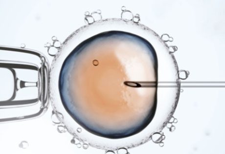 Obesity and fertility
