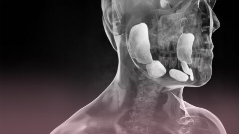 Orecchioni e infertilità maschile