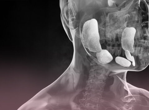 Orecchioni e infertilità maschile