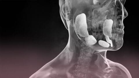 Mumps and male infertility