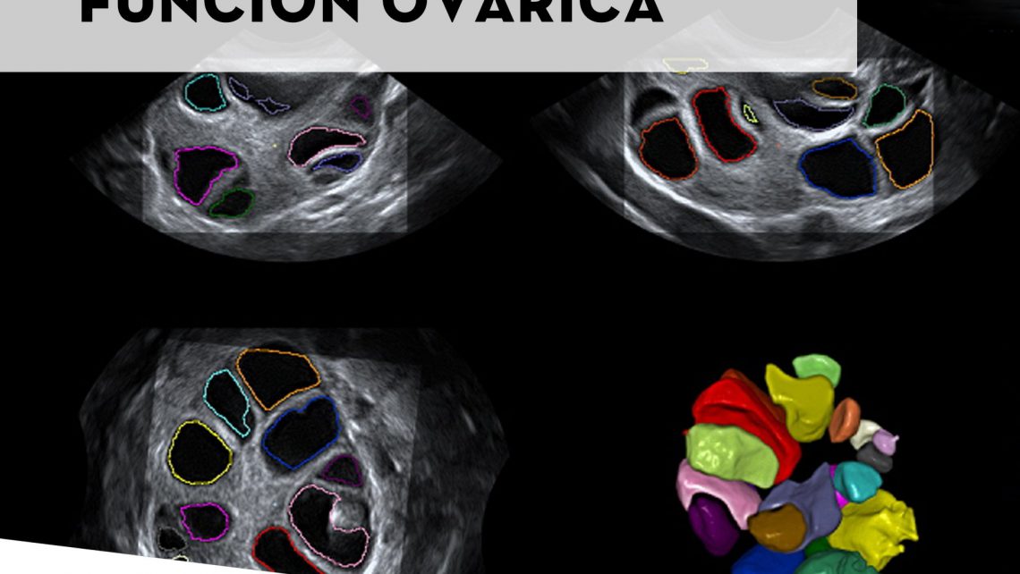 Resumen Jornada: “Función ovárica y baja respuesta” –  IV Máster en Medicina Reproductiva