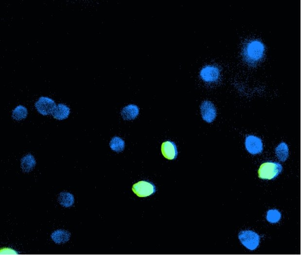 DNA fragmentation in sperm: TUNEL