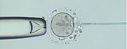 Desentrañando los enigmas de la ICSI (Inyección citoplasmática de espermatozoides)