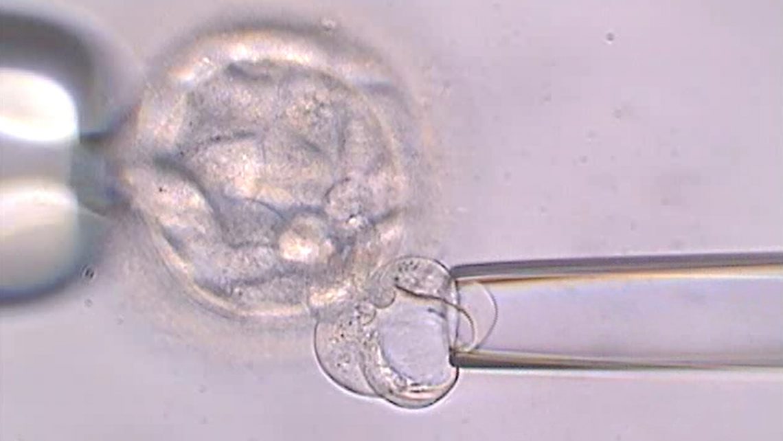 Biopsia del embrión para DGP