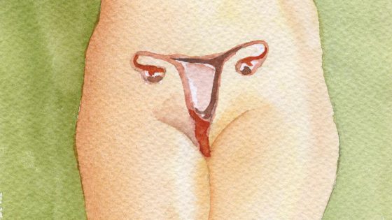 Endometritis; ¿Qué es? ¿Cómo detectarla? ¿Cómo curarla?