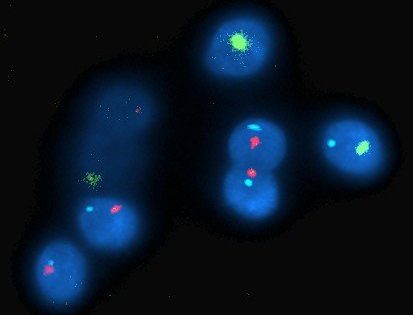 Diagnóstico Genético Prenatal