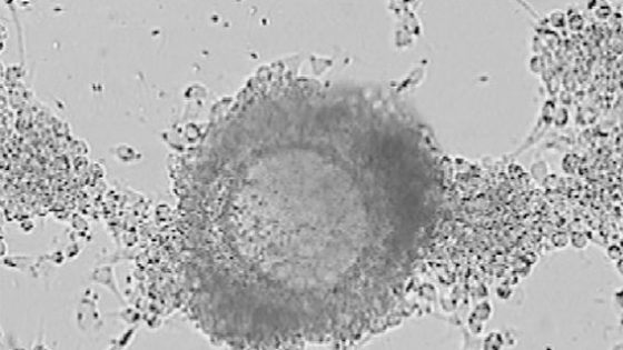 Cambio de indicación de TRA en el laboratorio de FIV, de FIV a ICSI