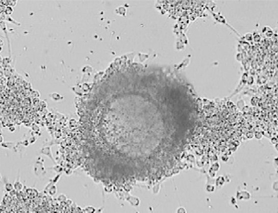 Cambio de indicación de TRA en el laboratorio de FIV, de FIV a ICSI