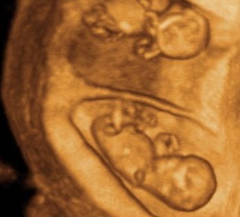 Primo mese di gravidanza: settimane 6-9 (prima visita ginecologica)