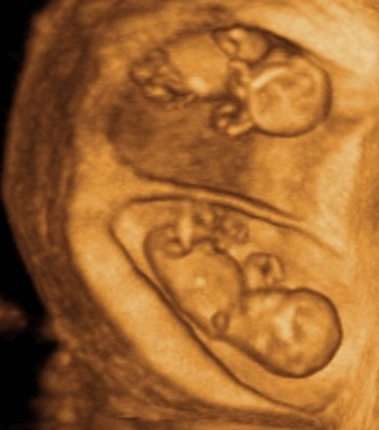 Primer mes de embarazo: Semana 6-9 (1ª Visita Ginecológica)