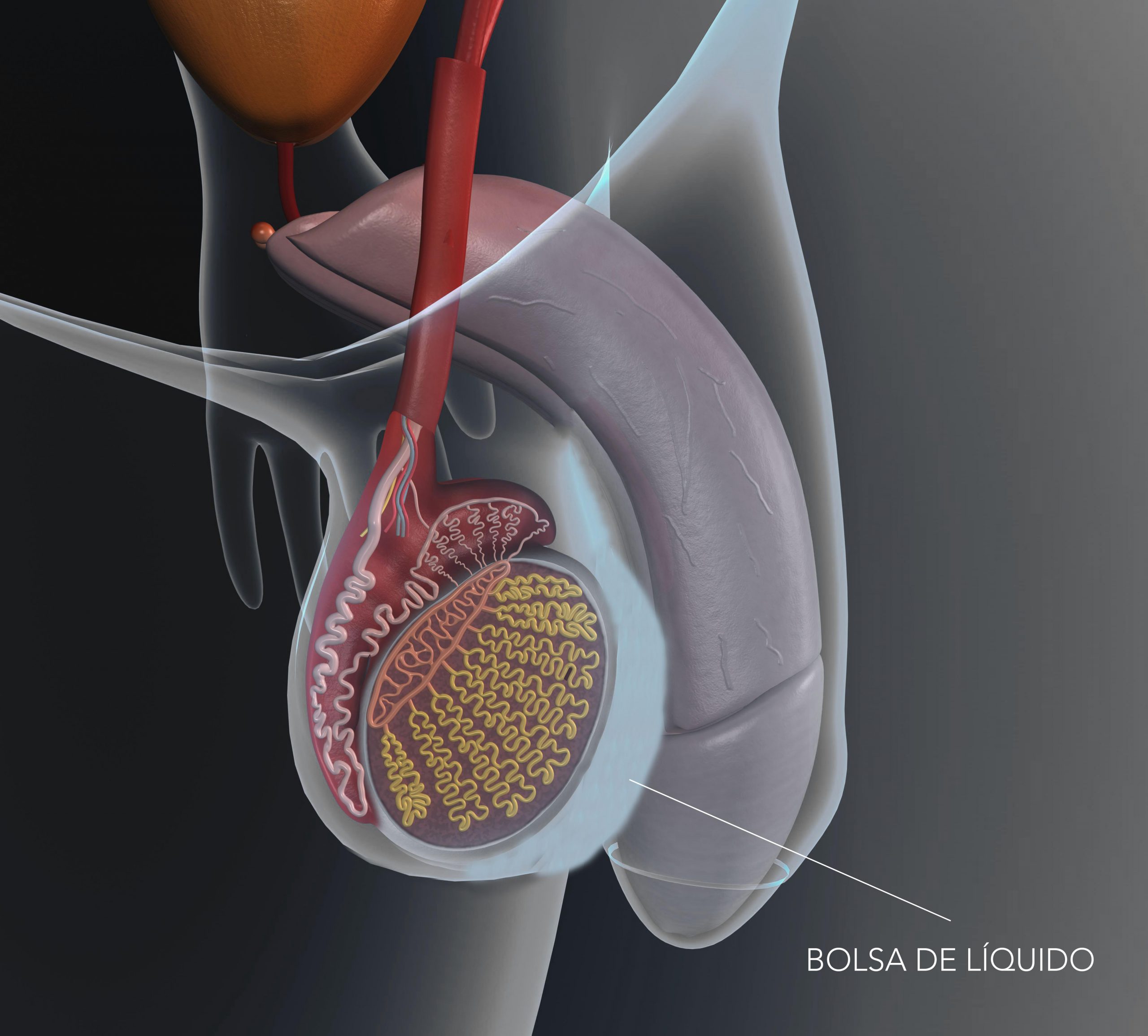 What is a hydrocele? Symptoms and treatment - Instituto Bernabeu