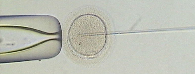 ICSI