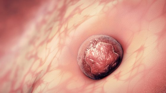 Saignement d’implantation embryonnaire