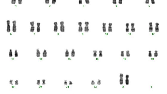 Genetic karyotype