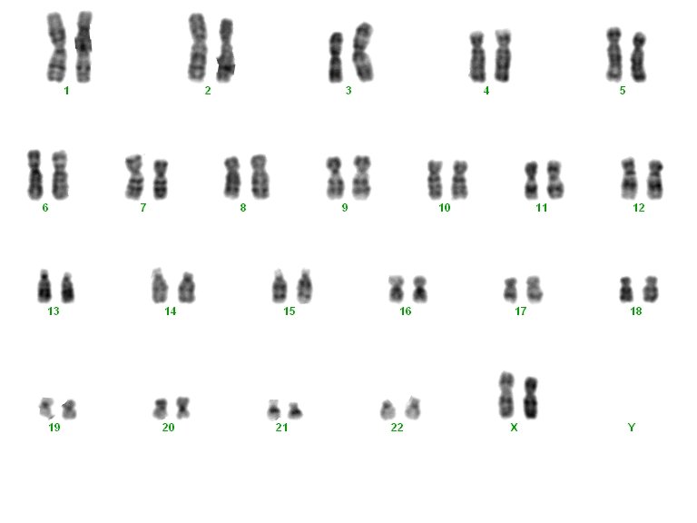 Genetic karyotype