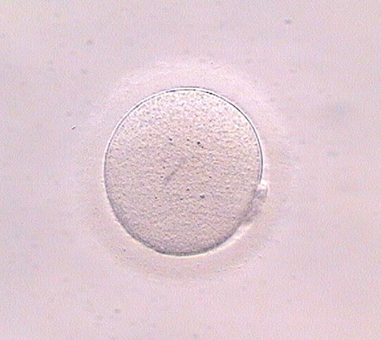 Dubbi, domande e risposte sulla vitrificazione di ovuli - Instituto Bernabeu