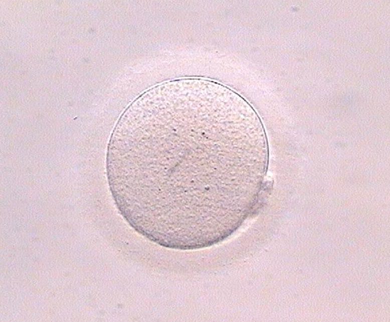 Dubbi, domande e risposte sulla vitrificazione di ovuli