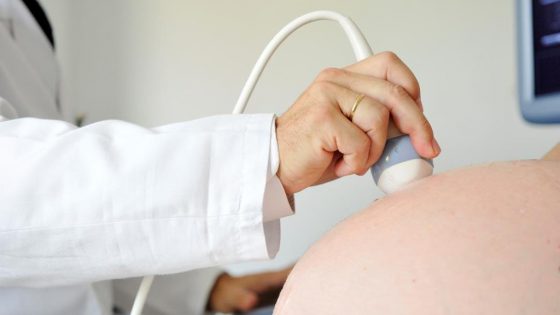 ¿Qué es la preeclampsia?, ¿podemos detectarla de manera precoz?