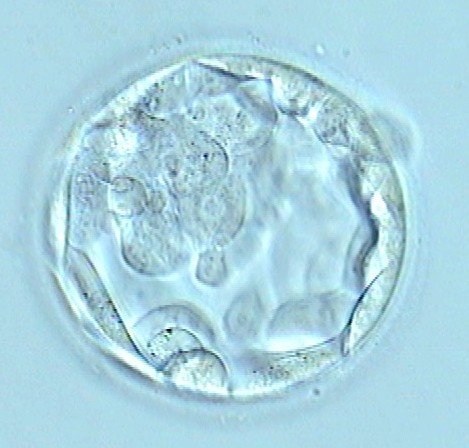 Transferencia del embrión en día 3 o día 5. Ventajas e inconvenientes