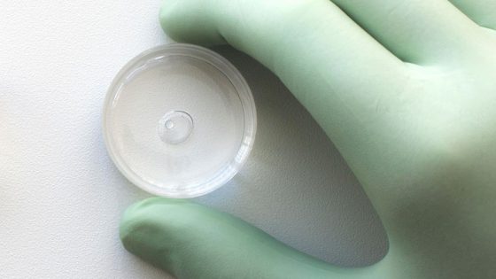 Diagnostic génétique préimplantatoire sans biopsie non invasive: niPGT-A