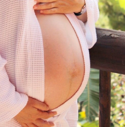 Síntomas frecuentes durante el embarazo