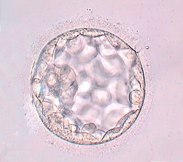 Transferencia embrionaria en día 5 y día 6. Ventajas e inconvenientes