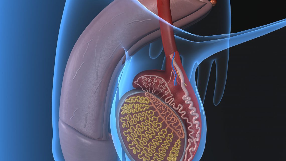 Fertilidad del varón en pacientes con cáncer testicular