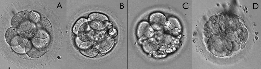 Types de fragmentation embryonnaire