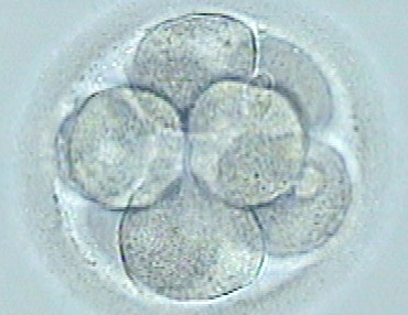 Blocco embrionario, perche’ i embrioni non si sviluppano iguali?