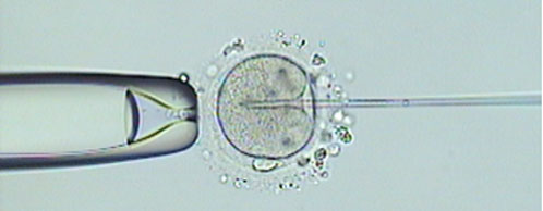 Gli enigmi della ICSI (iniezione intracitoplasmatica spermatozoi)