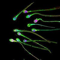 DNA Schäden und oxidativer Stress im Sperma. Eine Forschungsarbeit die vom Instituto Bernabeu auf dem Amerikanischen Fertilitäts Kongress (ASRM) vorgestellt wurde.
