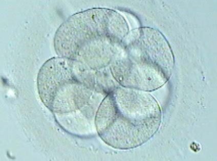 Evidencias para una nueva clasificación embrionaria: Conclusiones tras el estudio de 3000 embriones propios y donados. Investigación presentada en el reciente Congreso Americano de Medicina de Reproductiva (ASRM)