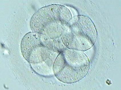 Evidence for a new embryo classification system : Conclusions after studying 3000 embryos, from own egg and from donor cycles. Research presented at the recent ASRM conference.