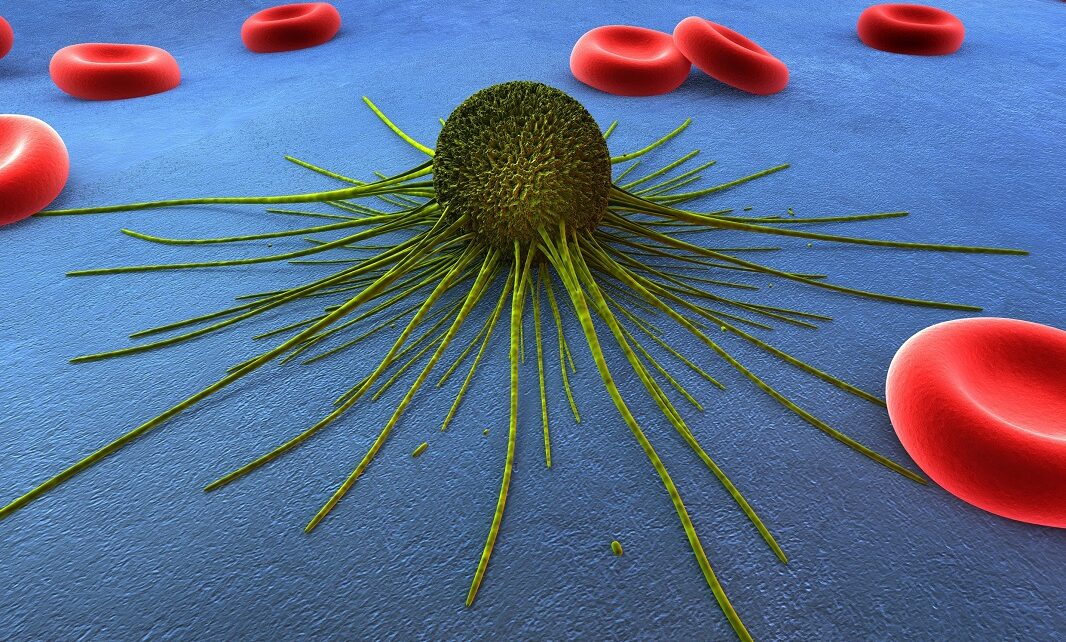 Aumenta la stimolazione ovarica per FIVET il rischio di cancro?