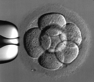 Éclosion assistée (assisted hatching)