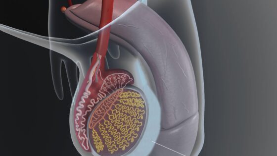 Was ist die Hydrozele? Symptome und Behandlung