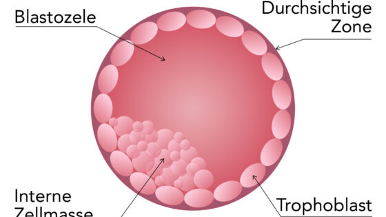 Embryo in der Blastozyste: Typen und Klassifizierung nach Qualität