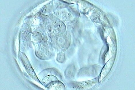 Trasferimento dell’embrione al 3º o 5º giorno di sviluppo