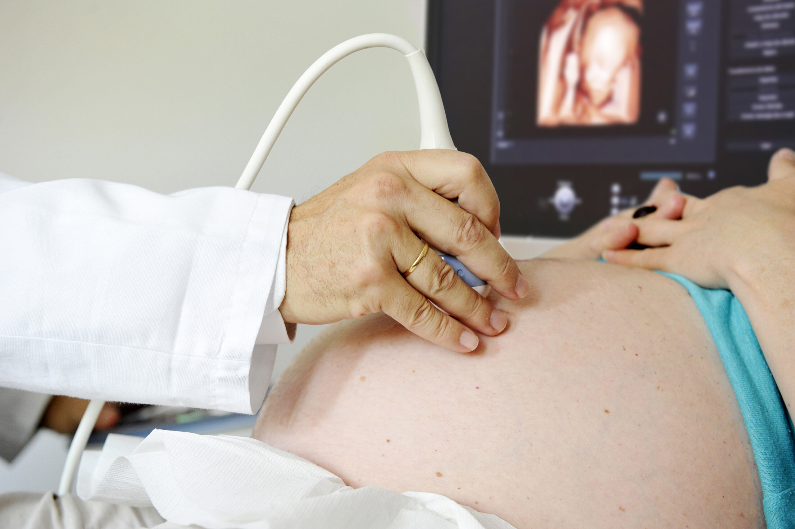 Ananiver equilibrado Sumergido Mayor control del embarazo en casos de abortos previos