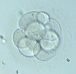 Vitrifizierung von Embryonen Wann und wie?