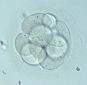 Embryo vitrification: when and how?