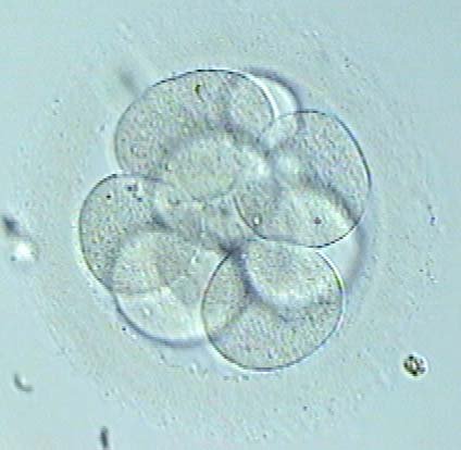 Vitrification de embryons. Types de embryons