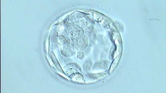 Blastocyst, advantages of a transfer on day 4 or 5